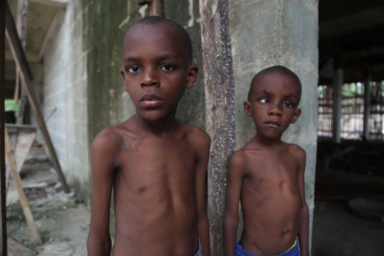 Overview 1 Illustration